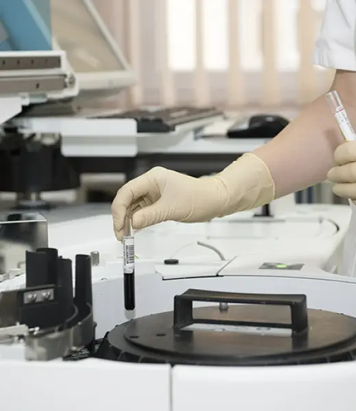 China ya hace pruebas clínicas con AD16, medicamento contra el Alzheimer